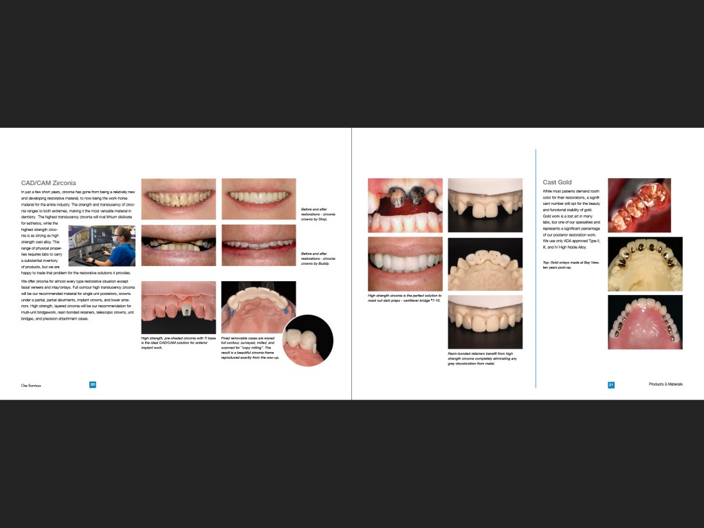 Bay View Dental Lab portfolio, page 22-23.