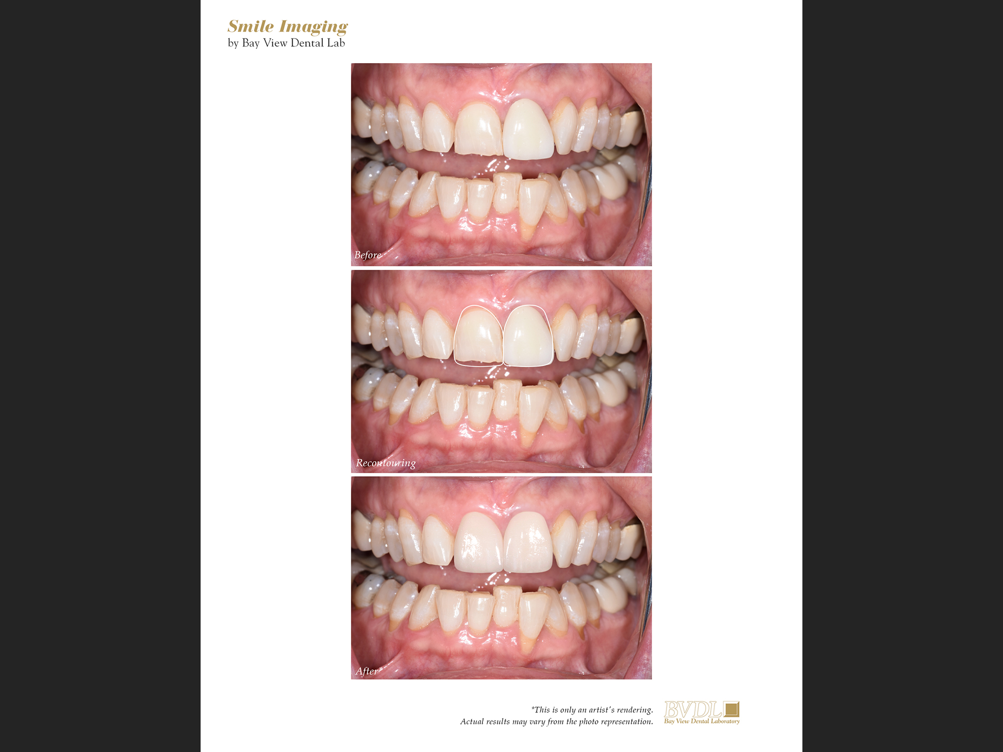 Creating new smiles with Photoshop.