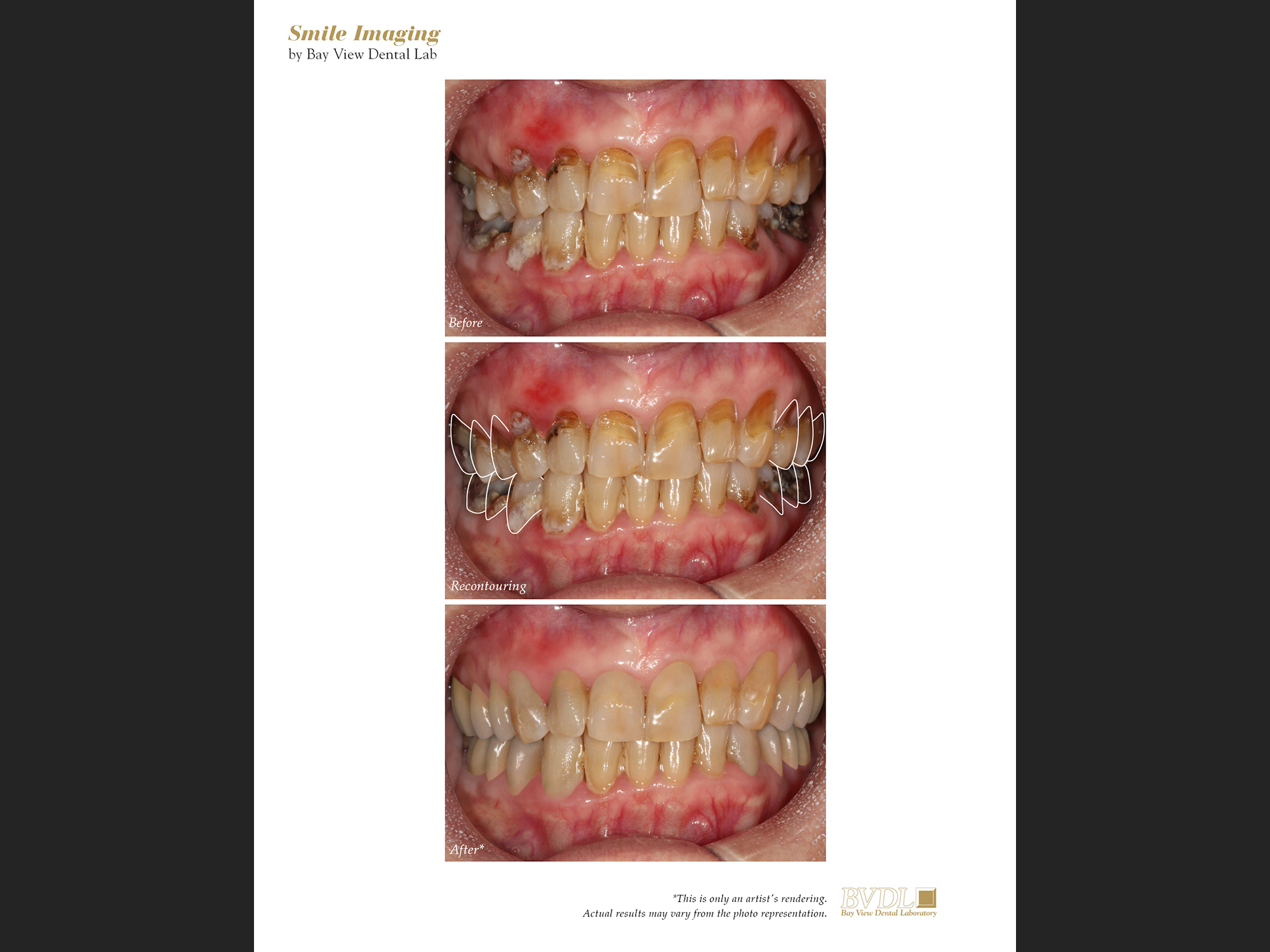 Creating new smiles with Photoshop.