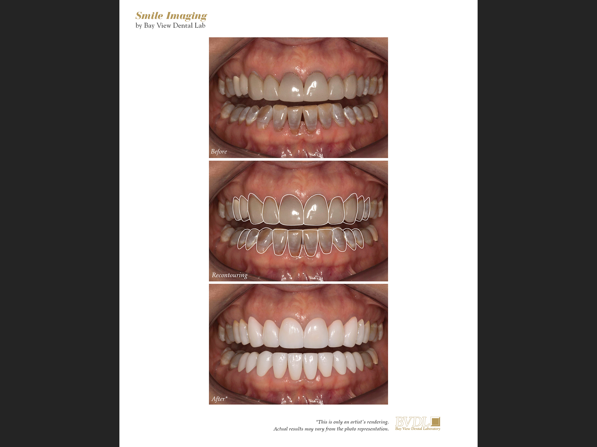 Creating new smiles with Photoshop.